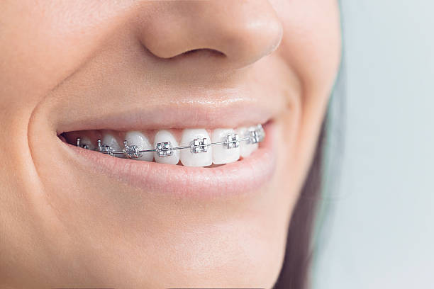 Best Invisalign and Clear Aligners  in Wetumka, OK